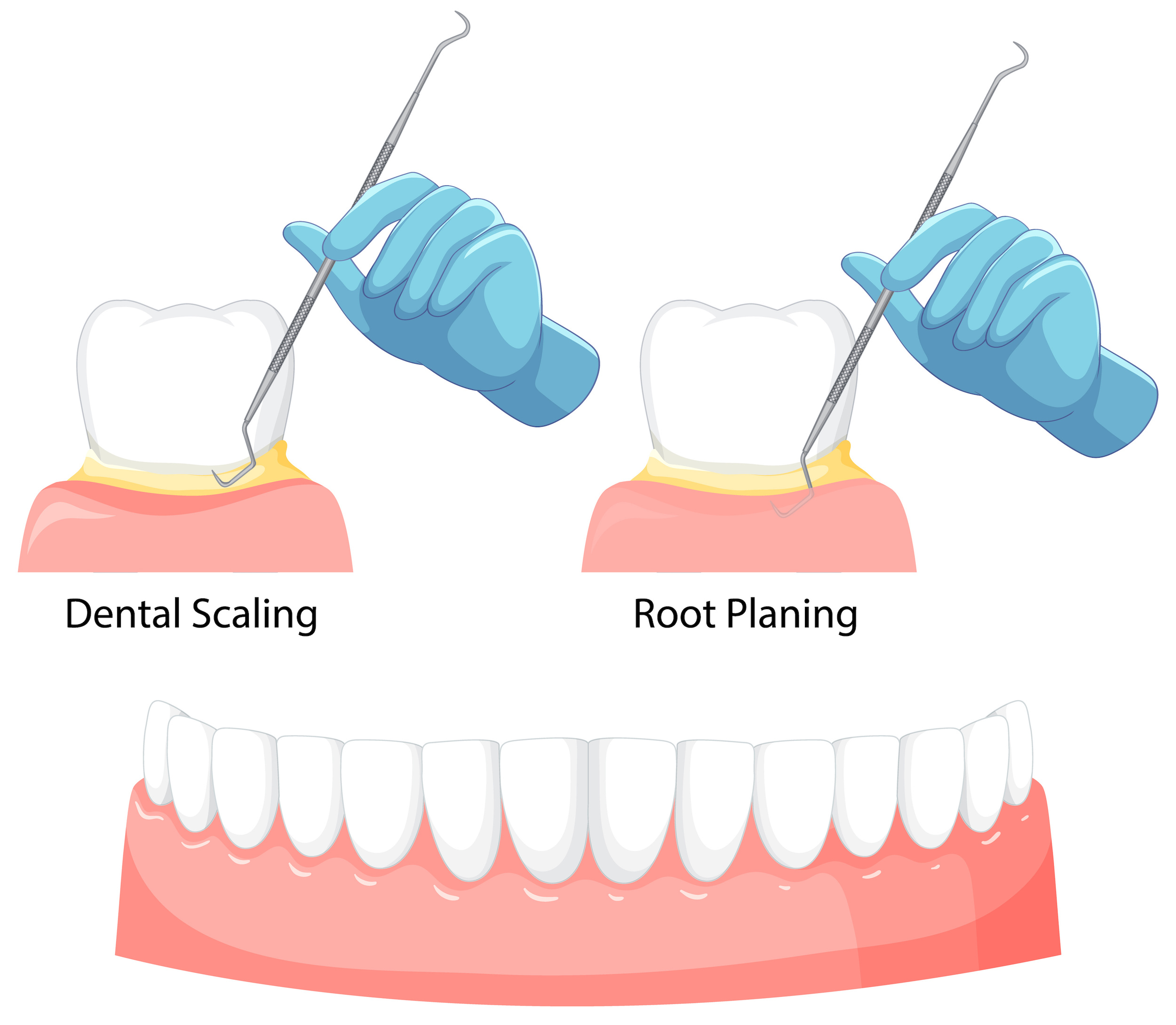 Image scale & root planning