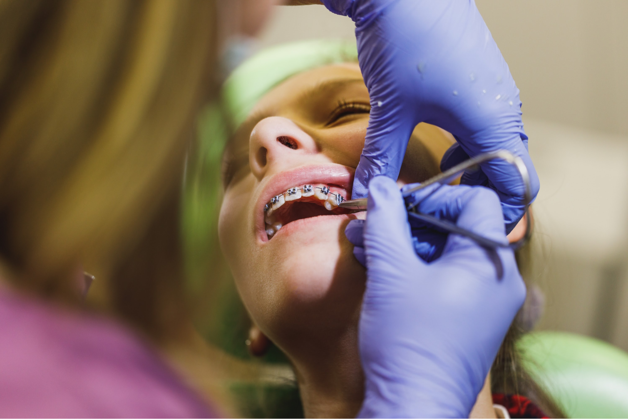 A child getting their braces put on.
