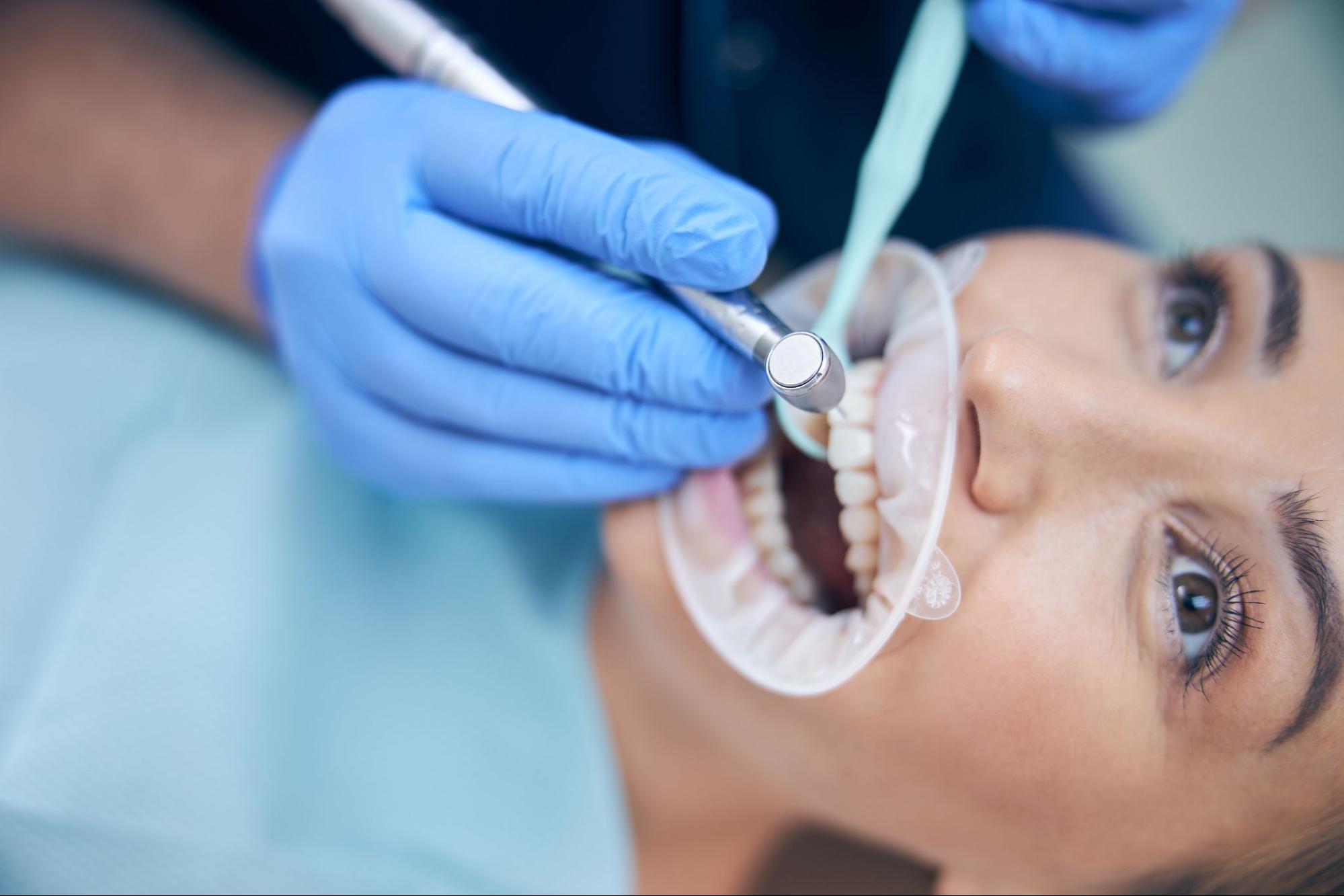 A woman gets a professional dental cleaning.