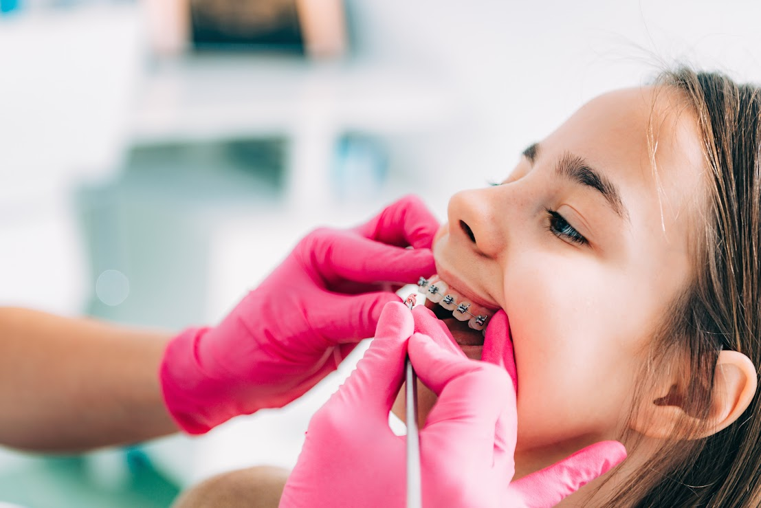 A young girl is receiving orthodontic care at the dentist. 